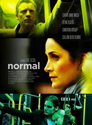 Normal