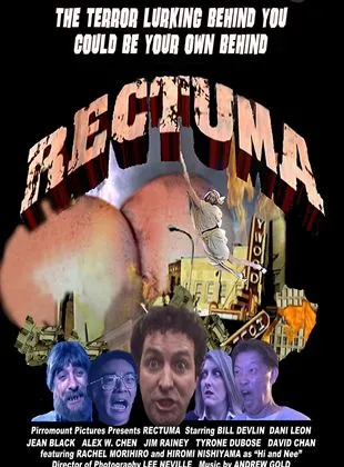 Rectuma