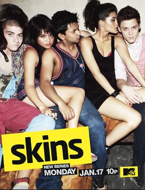 Skins (US)